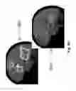 Fig. 27 - Device and method for whole-mind cognitive interface