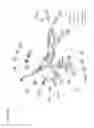 Fig. 05 - Method of identifying epileptic brain regions