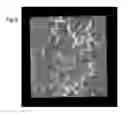 Fig. 06 - Processing optical coherency tomography scans