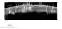 Fig. 07 - Processing optical coherency tomography scans
