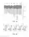 Fig. 02 - Device for tissue condition measurement