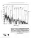 Fig. 07 - FILTERING PATIENT SIGNAL ALSO FOR VENTILATION ARTIFACTS