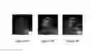 Fig. 06 - Method and apparatus for contrast-enhanced spectral mammography programmed sequences