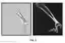 Fig. 04 - System and methods for automated segmentation of individual skeletal bones in 3D anatomical images