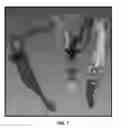 Fig. 08 - System and methods for automated segmentation of individual skeletal bones in 3D anatomical images