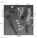 Fig. 09 - System and methods for automated segmentation of individual skeletal bones in 3D anatomical images