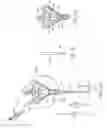 Fig. 05 - METHOD AND APPARATUS OF ECHOGENIC CATHETER SYSTEMS