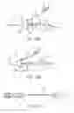 Fig. 16 - METHOD AND APPARATUS OF ECHOGENIC CATHETER SYSTEMS