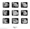 Fig. 02 - Medical imaging data processing apparatus and method