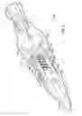 Fig. 07 - Hemostatic device and its methods of use