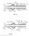 Fig. 17 - Hemostatic device and its methods of use