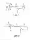 Fig. 03 - Finger traps for collapsible suture loops