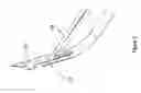 Fig. 06 - SUTURE ANCHOR WITH MICROTHREADS AND SUTURE ANCHOR DRIVER WITH NEEDLE ATTACHMENT