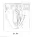 Fig. 06 - Method and apparatus for cardiac procedures