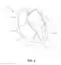 Fig. 08 - Method and apparatus for cardiac procedures