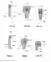 Fig. 05 - Joining devices, kits and methods