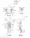 Fig. 12 - Joining devices, kits and methods