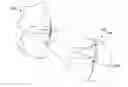 Fig. 01 - Knee joint capsular disruption and repair