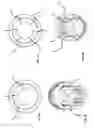 Fig. 08 - SURGICAL STAPLER