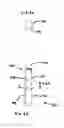 Fig. 03 - Positionable perivalvular occlusion device