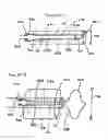 Fig. 35 - Positionable perivalvular occlusion device