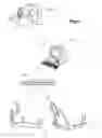 Fig. 07 - Orthognathic implant and methods of use