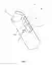 Fig. 09 - Bone material removal device and a method for use thereof