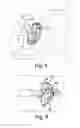 Fig. 07 - Orthopaedic surgical method and instrument assembly for reaming a patient's acetabulum
