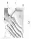Fig. 09 - Patient-specific bridging plates