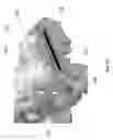 Fig. 13 - Patient-specific bridging plates