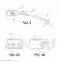 Fig. 03 - Kidney stone suction device