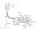 Fig. 01 - Systems and methods for separating tissue in corneal transplant procedures