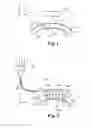 Fig. 02 - Systems and methods for separating tissue in corneal transplant procedures