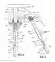 Fig. 04 - Laparoscopic scalpel and method for use