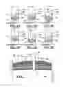 Fig. 05 - Laparoscopic scalpel and method for use