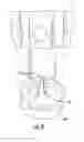 Fig. 09 - Access assembly for anterior and lateral spinal procedures