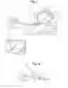Fig. 02 - Introducer for uterine tamponade assembly and methods of using the same