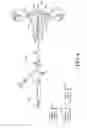 Fig. 07 - Polypectomy systems, devices, and methods