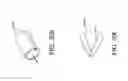 Fig. 46 - Polypectomy systems, devices, and methods