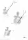 Fig. 08 - Devices and methods for minimally invasive immediate implant stabilization
