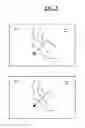 Fig. 09 - A MACHINERY FOR SURGICAL INTERVENTIONS OF CRYOABLATION WITH CLOSED CYCLE AND MULTIPURPOSE