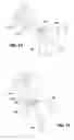 Fig. 17 - APPARATUSES AND METHODS FOR HIGH-DENSITY SENSING AND ABLATION DURING A MEDICAL PROCEDURE