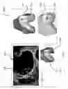Fig. 06 - SYSTEM AND METHOD FOR CREATING A DECISION SUPPORT MATERIAL INDICATING DAMAGE TO AN ANATOMICAL JOINT