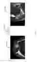 Fig. 07 - SYSTEM AND METHOD FOR CREATING A DECISION SUPPORT MATERIAL INDICATING DAMAGE TO AN ANATOMICAL JOINT