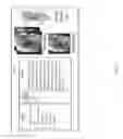 Fig. 08 - Surgery planning