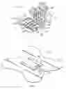 Fig. 02 - Stabilization device and method for surgical localization wire