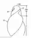 Fig. 01 - ENDODONTIC INSTRUMENTS WITH PILOT TIPS AND PARABOLIC CUTTING FLUTES