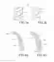 Fig. 03 - Method for producing a customized orthodontic appliance