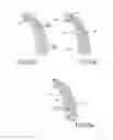 Fig. 04 - Method for producing a customized orthodontic appliance