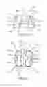 Fig. 08 - Method for producing a customized orthodontic appliance